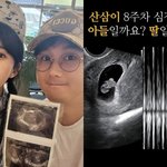 ‘40세 자연임신’ 강은비, <b>태아</b> 심장소리에 감동 “아들일까 딸일까”