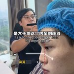 나 <b>구라</b>안치고 코 이사람처럼 생겻는데 수술할까