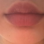 [댓글부탁해] 입술필러 개고민 되는디ㅠ