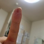 손아푸 <b>ㅠ</b>
