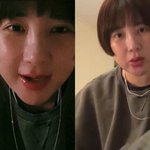 서인영 맞아? 이혼 후 10㎏ 찌고 성형 부작용 “코 실리콘 다...