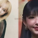 우주소녀 출신 <b>성소</b>, 퉁퉁 부은 얼굴 성형 의혹 해명 “약 부작용...