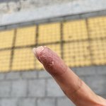 나 <b>토욜</b>에 피부과 다녀올게