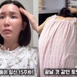 초아, 쌍둥이 임신 15주 "<b>실핏줄</b> 다 터졌다"..자궁경부암 극복...
