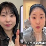 '성형비용만 1억5천' 이세영, 이번엔 귀필러..“얼굴 짧아진 느낌”...