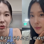 '45세' 이지혜, 시술 후 <b>탱탱</b>해진 얼굴 공개…"실리프팅 내돈내산"...