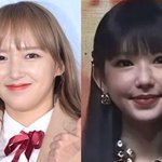 퉁퉁 부은 얼굴→성형 부작용?…'우주소녀 출신' <b>성소</b>, 깜짝 근황