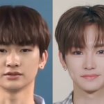 이 <b>남돌</b> 성형 결과 ㄷㄷ