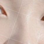 [19] <b>나코</b>수술전후볼사람