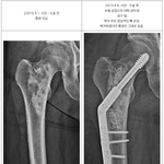 사이코 의사에게 당했습니다. (2)
