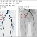 사이코 의사에게 당했습니다. (3)