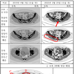 사이코 의사에게 당했습니다. (4)