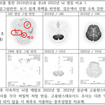 사이코 의사에게 당했습니다. (5)