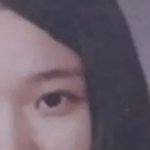 에스엠 진짜 앞트임 <b>맛집</b>이다