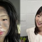 지예은 런닝맨 하차 이유, 번아웃 아닌 ‘이것’이었다 (+악플,...