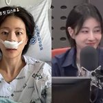 못 쉬어” 코뼈 골절 이현이, <b>날렵</b>한 콧대 복원 완료‥더 예뻐졌네...