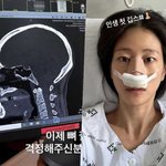 .이현이, 골절 부상 '<b>SBS</b> 산재처리' 받나 "잘 회복되길"...