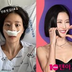 이현이, <b>코뼈</b> 골절 소식 하루만에 기쁜 소식 전했다…"완벽하게...