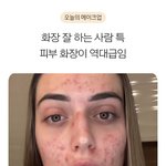 서양인 언니 <b>피부</b>가 충격적이야