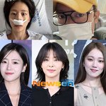 키운다‥연예계  부상 도미노,<b>코뼈</b> 골절 ·수술 ·전치 8주 [스타와치]