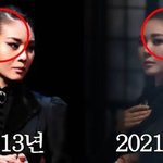 ‘탈모’ 뮤지컬 배우 고충→<b>모발</b> 이식 부작용 “이게 무슨 일인가”(눙주현채널)