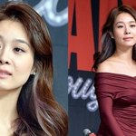 억만금 있어도"…옥주현, 탈모→<b>모발</b>이식 부작용 고백 [RE:뷰]