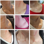 [도와주세요] 흉터 사진有// <b>연남동</b> OOO에서 목걸이 사고 목에...