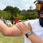 둘째 子 가을 운동회 MVP.."줄다리기하다 영광의 <b>상처</b>까지"