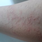 고양이 꾹꾹이 너무<b>아파</b>
