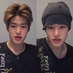 <b>비니</b>가 붓기를 어케 가려주는거지