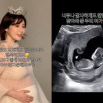 아이 엄마 된다…"태명=<b>베리</b>, 둘째 고민 끝 홀가분해" [해시태그]