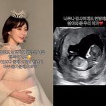동창' 나비, 둘째 임신 발표 "내년 4월 출산..태명은 <b>베리</b>"