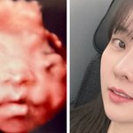 '<b>난임</b> 극복' 양현민최참사랑, 뱃속 딸 초음파 공개 "엄마 닮으렴"