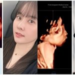 임신' 양현민최참사랑, 붕어빵 <b>초음파</b>에 감동 "엄마 더 닮으렴"...
