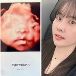 임신' 최참사랑양현민, 딸 <b>초음파사진</b> 공개 “아빠보다 엄마 닮으렴”