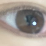 자고일어낫는데 아직<b>충혈</b>됨