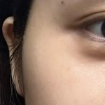 얘들아 나 옆<b>광대</b> 쳐야될거같음?