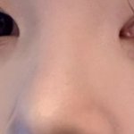 [드루와] 얘들아 나 코<b>수술</b> 할말