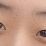 [드루와] 나 <b>수술</b>하는게 나을 눈일까..?