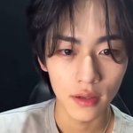 [댓글부탁해] <b>피기</b>오겔 쓰면 농포성?여드름 ㅈㄴ올라오는데