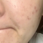 아니 이제 겨울이야?? <b>겨울철</b> 피부관리 다들 어떻게해?