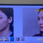 '환승연애2' 이나연, 코 재수술 결정…성형 <b>전후</b> 공개