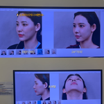 성형 전 얼굴 공개..“예전 코로 <b>복원</b> 수술하기로”(‘일단이나연’)