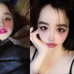 “치료 절실”…박봄, ‘양현석 고소장’ 논란 뒤 2주만 <b>SNS</b> 재개