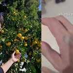 ‘이혼’ 최동석, 주먹 쓰다가 다친 손..“<b>한판</b> 붙었다”