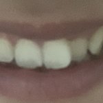 <b>교정</b>할까말까