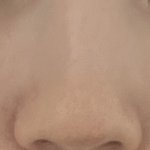 코 <b>수술</b>하거싶은데