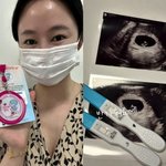 ‘쌍둥이 임신’ 오초희, 40대 <b>노산</b> 우려에 일침 “너무 늦었다고?...