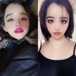 소통 원활하지 않다더니…박봄, 2주 만에 "건강 원래 완전 괜찮아"...