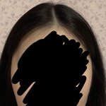 시술 잘알들아 제발 나좀 도와줘